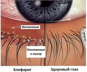 Натуральные витамины для глаз при глаукоме thumbnail