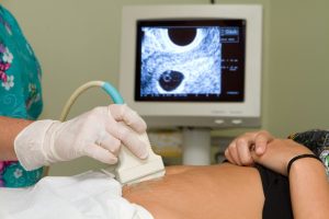 Пульсация при беременности на ранних сроках внизу живота thumbnail
